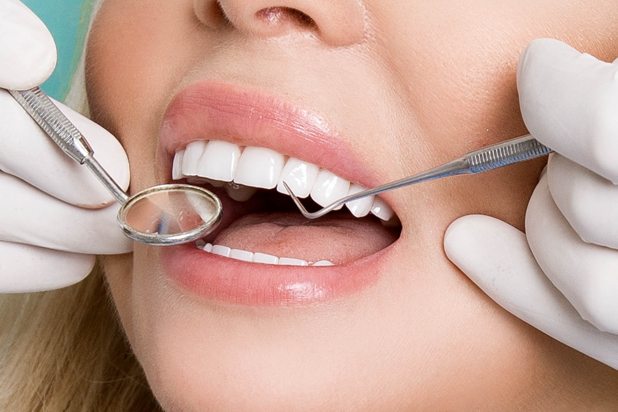 Three Types of Dental Cleanings